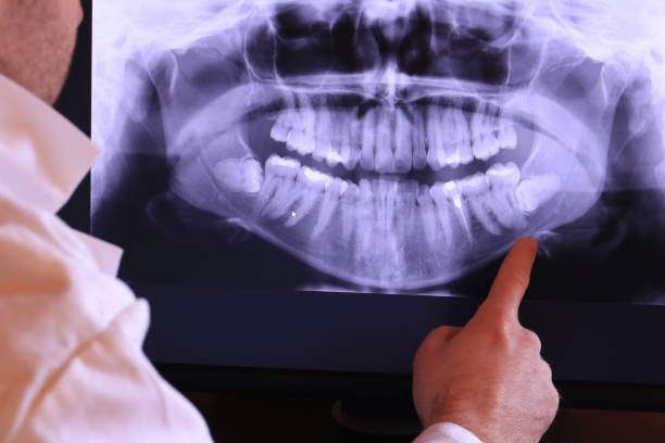 Best Pediatric Emergency Dentist in Palisades Park, NJ