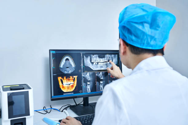 Best Emergency Root Canal Treatment in Palisades Park, NJ